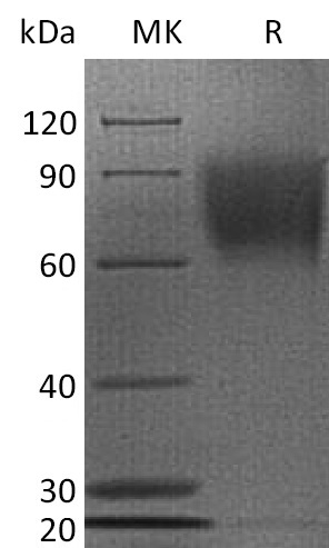 Human CD30 +SDS-PAGE-2.jpg
